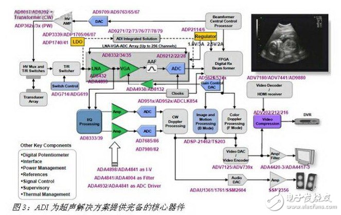 ADI為超聲解決方案提供完備的核心器件