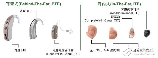 幾類用于可穿戴醫(yī)療的半導(dǎo)體方案