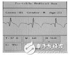  基于STM32的便攜體檢裝置的設(shè)計與實(shí)現(xiàn)