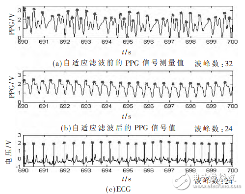 一種基于STM32和PPG技術的腕戴式心率計設計